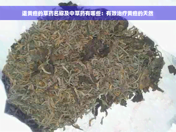 退黄疸的草药名称及中草药有哪些：有效治疗黄疸的天然