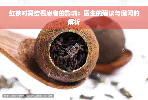 红茶对肾结石患者的影响：医生的建议与健网的解析