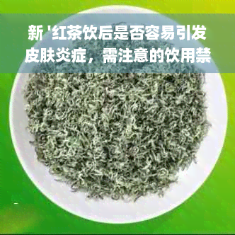 新 '红茶饮后是否容易引发皮肤炎症，需注意的饮用禁忌'