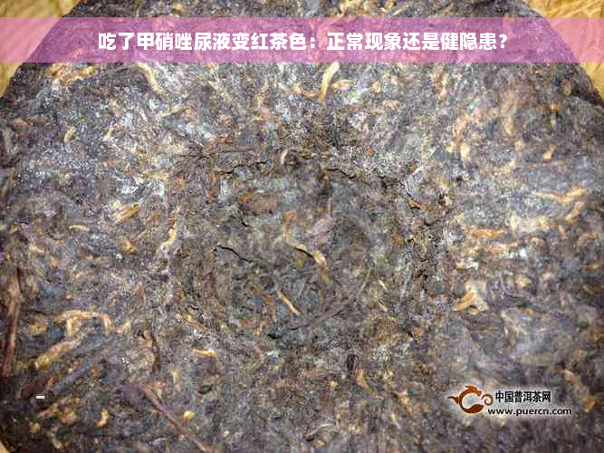 吃了甲硝唑尿液变红茶色：正常现象还是健隐患？