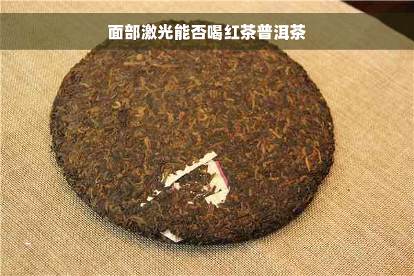 面部激光能否喝红茶普洱茶