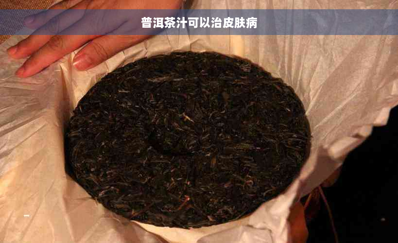 普洱茶汁可以治皮肤病