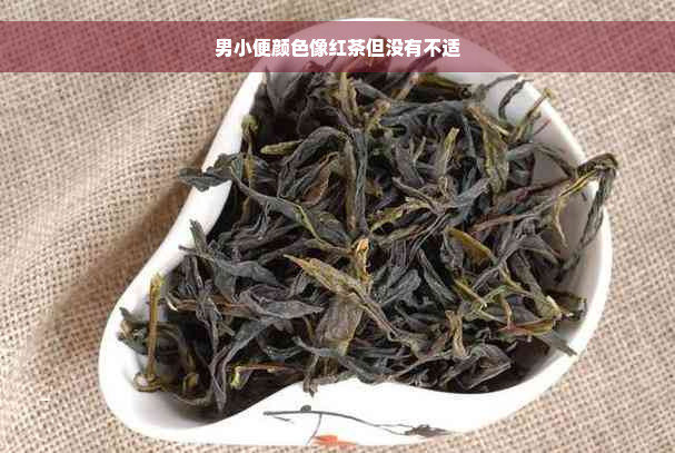 男小便颜色像红茶但没有不适